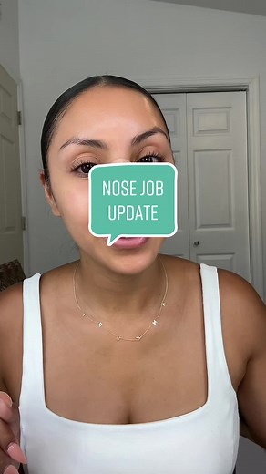 4 Week Post Rhinoplasty Update - Recovery Process Insights