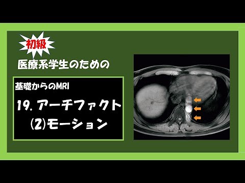 【MRI基礎】 19．MR アーチファクト (モーション)