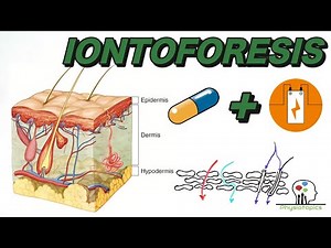 Iontoforesis (explicado)
