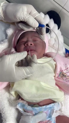 Doctor Performs Suction on MSL Baby | Quick Action Saves Life