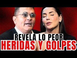 CARLOS VIVES DESTROZADO tras ANUNCIO DE CARMÉN VILLALOBOS por HERIDAS Y GOLPES ¡URGENTE!