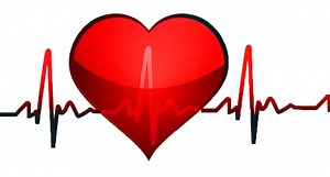 Tachycardia: important things to keep in mind for treatment