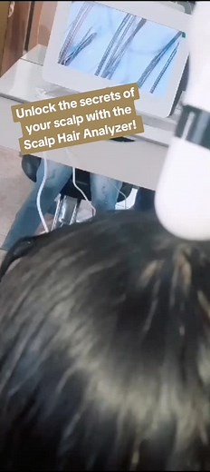 Scalp Hair Analyzer: Revolutionize Your Hair Health