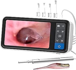 3.5mm Digital Otoscope Camera with Light, Visual Ear Camera and Ear Wax Tweezers with Light, Video Ear Scope with Ear Wax Remover, Ear Endoscope Cleaner, 32GB, 1080P HD