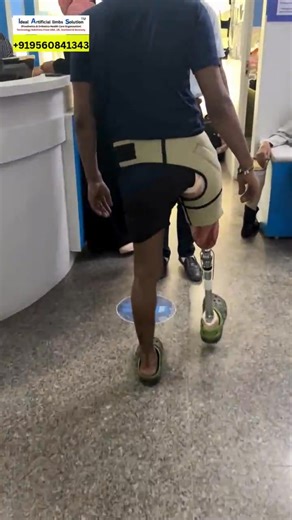 Ideal Artificial limbs Solution on Reels