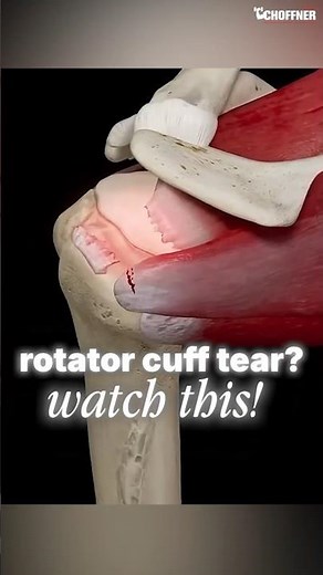 Rotator Cuff Tear Rehab, Mobility + Strength