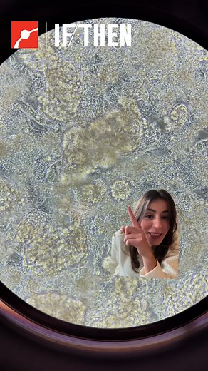 You’re looking at tiny beating hearts, grown entirely in a lab. 🫀 Marie, also known as Lab Skills Academy, walks us through how scientists turn cells into induced pluripotent stem cells, also known as iPSCs, and guide them into becoming cardiomyocytes: heart cells that beat in rhythm just like yours. They’re not full hearts, but they do contract on their own making them a powerful tool for studying how real human cells respond to drugs and genetic changes, all in a dish. #Biotech #Health #StemC