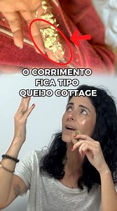 11K views · 1K reactions | Águia 礪 , esse aí é um dos corrimentos que não tem como achar que talvezzzz seja ok. É pereba é só resta descobrir qual delas. Típico de candidíase ou vaginite citolítica. Nem todas manifestam dessa forma, não precisa ter apenas grumos pra configurar uma candidíase . O corrimento vem de vários aspectos e esse e apenas um que, como disse, e pereba de fato. | Enfª Pri Araujo | Facebook