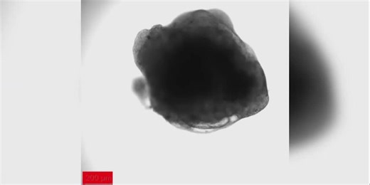 MSU researchers develop ‘mini heart’ to advance atrial fibrillation treatment