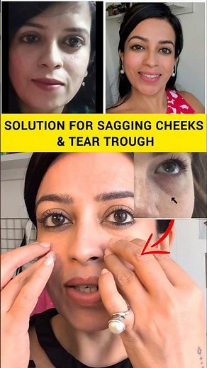 Stop Sagging Cheeks & Tear Troughs Naturally! #faceyoga