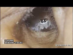 Instagram's Top 10 Cysts, Pimples, Ingrown Hair & Medical Clips!