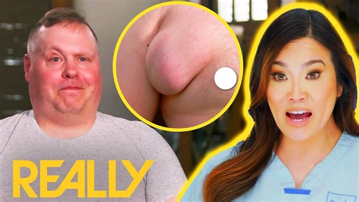 Dr Lee is faced with an extremely challenging task when she gets a visit from Chris, who has a lipoma in a very precarious location – his armpit! Dr Pimple Popper: This Is Zit 1310 #pimple #popper #drpimplepopper #drsandralee | Pimple Daily Post
