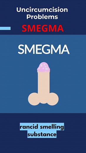 Understanding Smegma: Causes, Symptoms, and Solutions