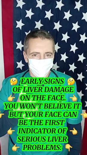 Early Signs of Liver Damage on Your Face