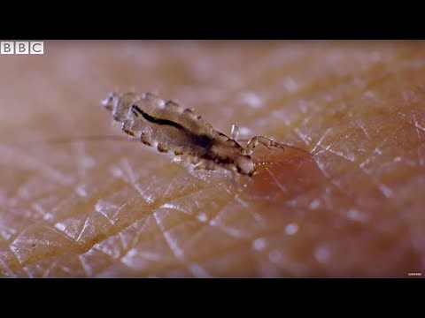 Presenter Gives Himself Head Lice On Purpose! | Earth Science