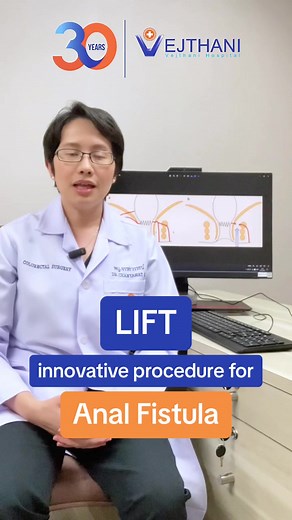 LIFT is an innovative procedure to treat Anal Fistula. Studies show that this procedure has 80-90% success rate and relieves the symptoms after the procedure. Learn more how LIFT is done to treat anal fistula. #LIFTprocedure #Analfistula #colorectalsurgeon #HealthcareInnovations #vejthanihospital #hospitalbangkok
