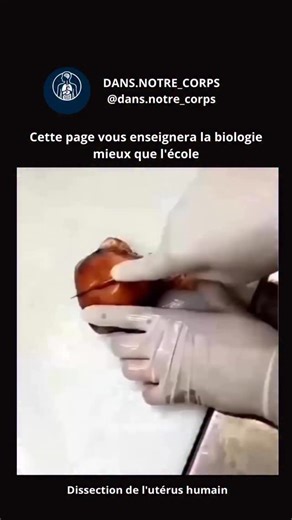 DANS.NOTRE_CORPS on Instagram: "La dissection de l’utérus humain révèle un organe creux, musculaire et piriforme, situé dans la cavité pelvienne entre la vessie et le rectum. Lors de la dissection, l’utérus est examiné extérieurement (fond, corps et col) et intérieurement (ses trois couches distinctes). Le périmétrium, la couche externe, assure la protection ; le myomètre, épais et composé de fibres musculaires lisses, est responsable des puissantes contractions lors des menstruations et de l’ac