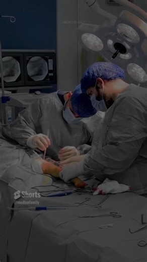 DDH deformaty surgery 🔩🛠️ #shorts #surgeon #doctor