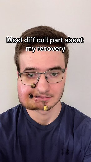 Recovering from Surgery: Overcoming Mobility Challenges