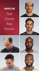 1.7K views | ✨ Check out these incredible before-and-after transformations that our clients achieved with Xtrands+! ‍♂️ Whether you're looking for more volume, thickness, or a fresh new look, we tailor our solutions to give you the hair you want—just the way you like it! Ready to take control of your hair? Learn more about our personalized options at hclub.cc/xtrandsplus #HairClub #beforeandafter #hairloss #hairlosssolutions #malepatternbaldness #Xtrands+ | HairClub | Facebook