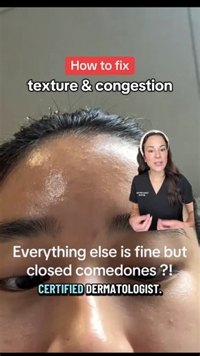 Lindsey Zubritsky, MD, FAAD on Instagram: "Comment CONGESTION if you wanna get your hands on THE best product for congested, textured, or comedone prone skin 🫡 One of the reasons I decided to start @dermclick was because yall. The comments, the DMs, the messages asking how to get prescriptions like tretinoin or that the wait to see a derm was months long. So with this, im hoping to make your life jus a little bit easier 😃 Stitch with @crystallai3 on 🕰️ What’s worked for your congested skin? L