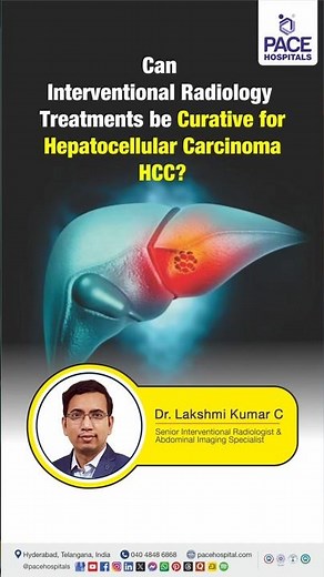 Can Interventional Radiology Treatments be Curative for HCC? | Effectiveness of IR for Liver Cancer