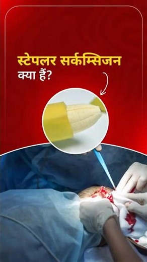 No Pain, Faster Healing! |What Happens in Stapler Circumcision | Dr. Sanish Shringarpure #shortsfeed