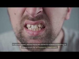 What is a tooth extraction and when is it necessary?