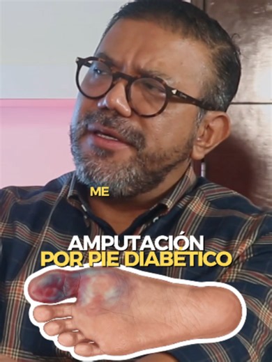 ¿Qué es el Pie Diabético? Explicación del Dr. Flores Nazario