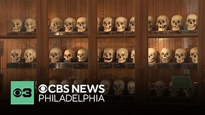 The Mütter Museum is updating its approach to managing its human remains collection