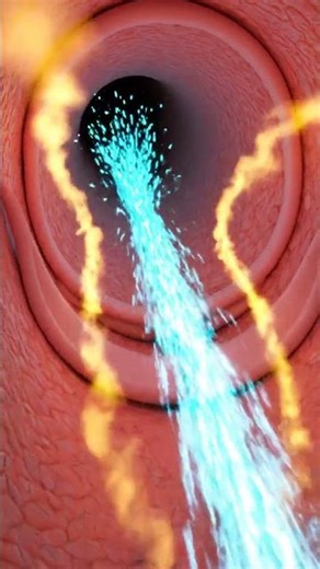 High Frequency Jet Ventilation