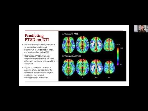 Breakthroughs in Diffusion Tensor Imagining Illuminate Triple Network Model