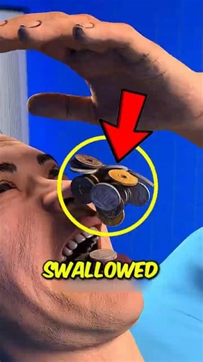 Craziest Things People Swallowed... That Became Deadly😱