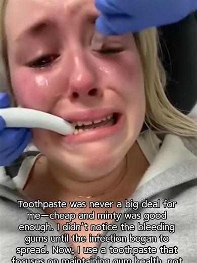 At 4:36 a.m. on February 23, 2026, my tooth swelled and ached so severely that pus began oozing out. The emergency room doctor informed us it had progressed to sepsis and required immediate emergency surgery. That was one of the most terrifying moments of my life—I truly believed my life was ending right then. After discharge, the doctor repeatedly emphasized the necessity of strictly adhering to his dental care recommendations, including using a specific toothpaste to maintain dental health.#or