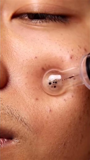 Deep Facial Pore Cleaning — ASMR