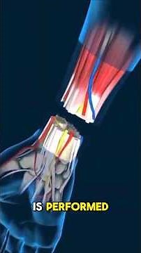 Hand transplant surgery? #medical #medsurgery#transplants #surgery