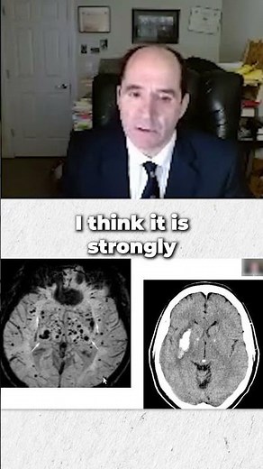 What is amyloid angiopathy of brain?