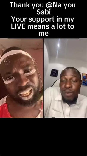 BLACKALBINO on TikTok