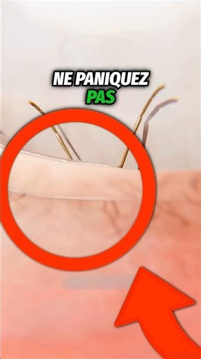 Si une mouche rentre dans votre œil ! 😰