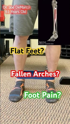 This One Exercises Fixes Flat Feet