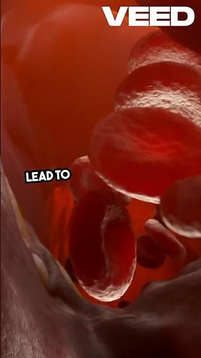 Unlocking VLDL The Cholesterol Connection!