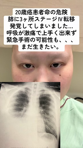 20歳癌患者の絶望と希望