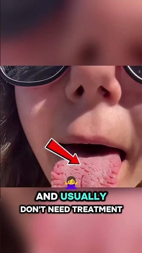 If Your Tongue Has Cracks, DON'T PANIC! 😱👅