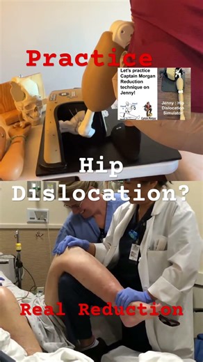 Practice on patient or Practice on simulator? Captain Morgan Technique! #orthopedic #hipdislocation