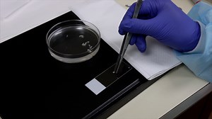 3D Imaging of the Liver Extracellular Matrix in a Mouse Model of Non-Alcoholic Steatohepatitis