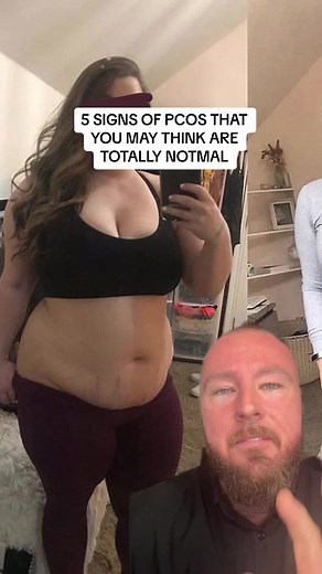 PCOS is a complex metabolic & hormonal condition, meaning that it can impact you in so many ways! Here are 5 symptoms that are super common but a lot of people actually don't connect them to their PCOS. Do you experience any of these PCOS symptoms?