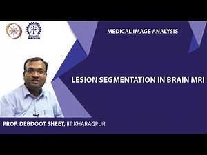 Lesion segmentation in Brain MRI