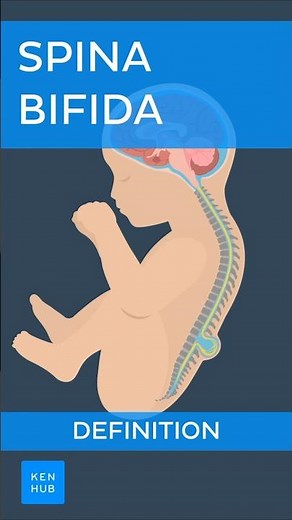 Spina bifida: Definition | Kenhub #spinabifida