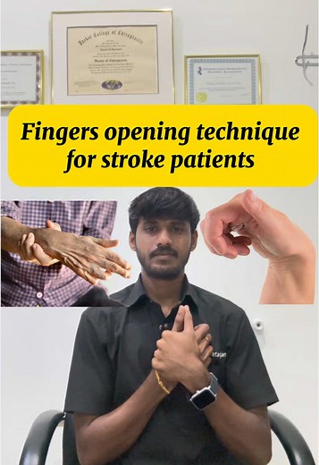 The tonic thumb reflex is closely related to the general extension reflex. The response of the thumb becomes intensified if the forearm is supinated maximally when the arm is elevated #uaetamil #dubaitamil #abudhabitamil #dubaitamiltiktok #singaporetamil #singaporetamiltiktok #malaysiatamil #malaysiatamiltiktok #tvk #stroke #pain #exercises #stretching #hand #handrehabilitation #tamilvideo #tamil #tamillyrics #tamilstatus #tamilsonglyrics #tamilsongs #tamilbgm #tamillovesong #tamilactress #tamil
