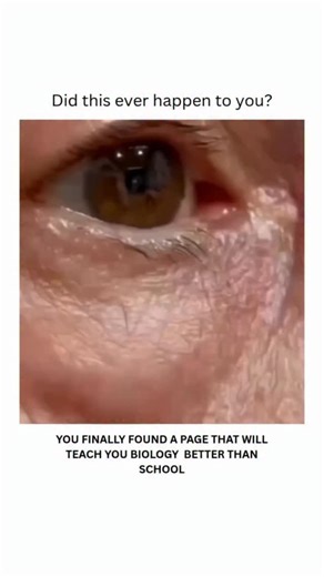 Bit Health Coin on Instagram: "👀 Ever had that random eye twitch? It’s called myokymia — small, involuntary muscle quivers, usually around the eyelid. Most of the time, it’s harmless. Common triggers? 😴 lack of sleep ☕ too much caffeine 😓 stress or fatigue 💡 Pro tip: adding magnesium may help reduce twitching for some people. It’s usually nothing serious, but if it happens often or spreads, it’s worth checking in with a doctor. #science #learn #knowledge #foryou #viral #viralreels #trending 